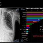 L’intelligenza artificiale in Radiologia: