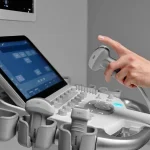 Quanto costa un Ecografo? Il miglior rapporto qualità-prezzo.