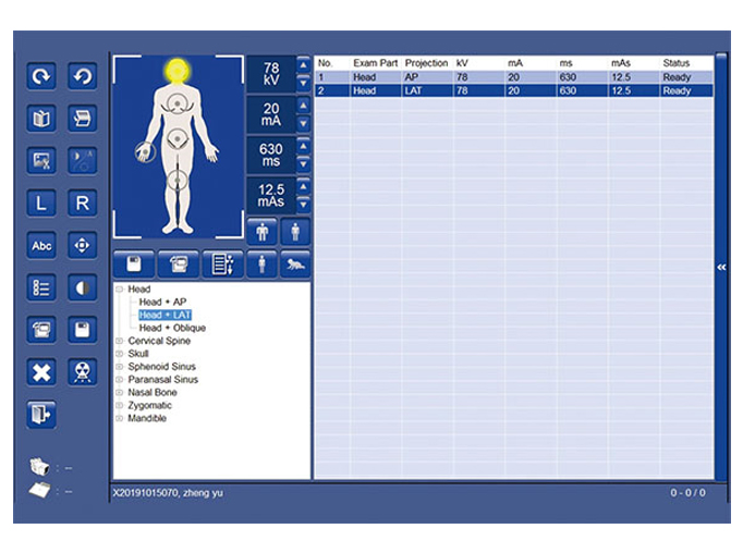 SR-2300 Sistema radiologico domiciliare portatile