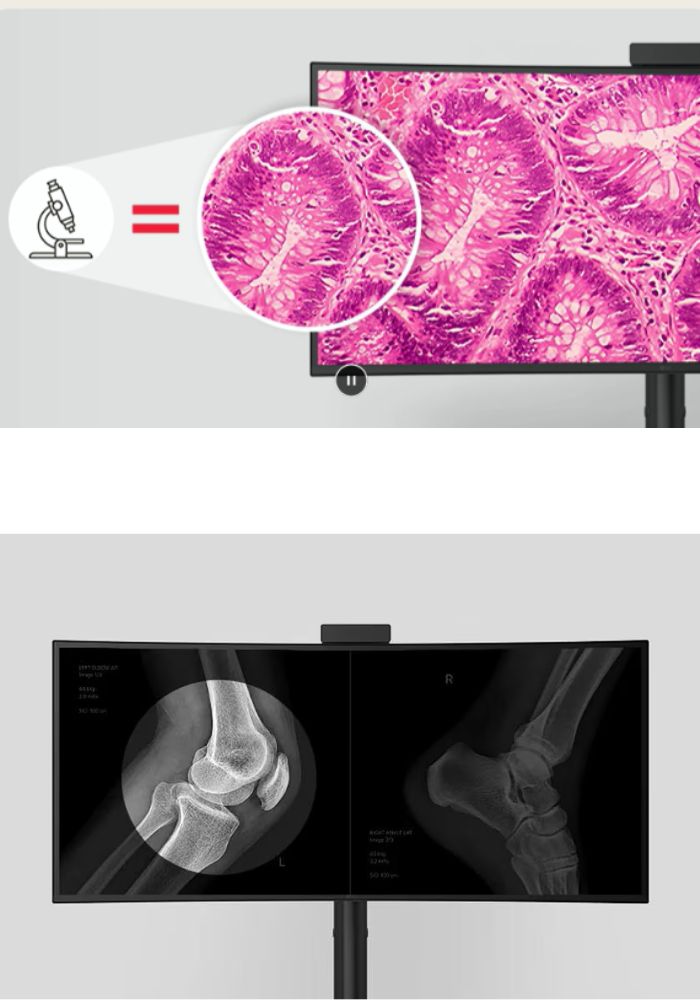 monitor-medicali-diagnostici-lg-puglia